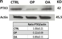 Western blot - Anti-Pentraxin 3/PTX3 antibody [MNB1] (AB90806)