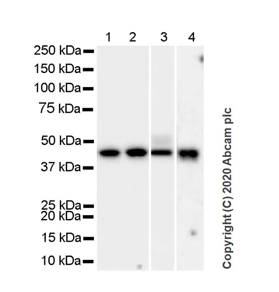 Western blot - Anti-Pentraxin 3/PTX3 antibody [MNB1] (AB90806), expandable thumbnail