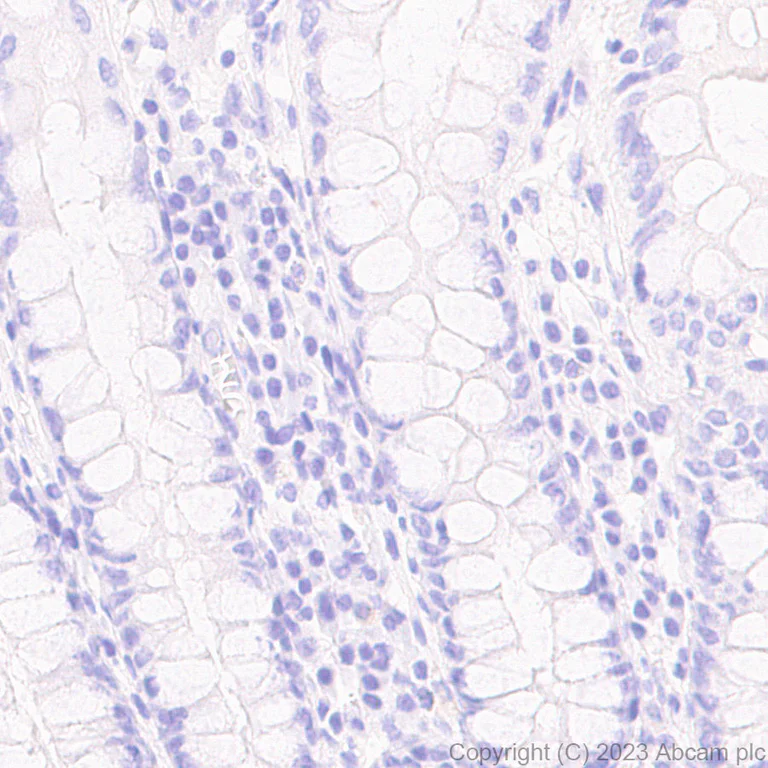 Immunohistochemistry (Formalin/PFA-fixed paraffin-embedded sections) - Anti-Pepsin antibody [EPR28182-66] - BSA and Azide free (AB312853)