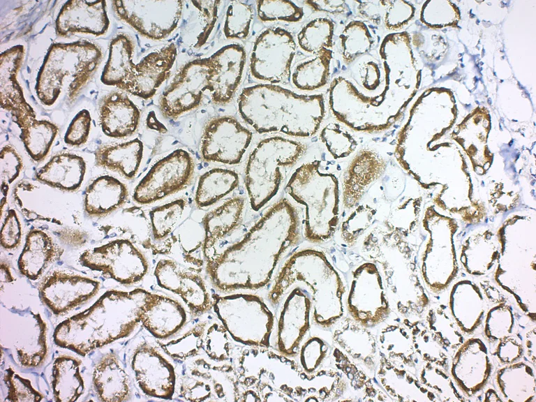 Immunohistochemistry (Formalin/PFA-fixed paraffin-embedded sections) - Pepsin Solution (Antigen Retrieval) (AB64201)