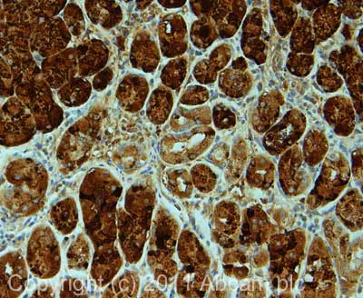 Immunohistochemistry (Formalin/PFA-fixed paraffin-embedded sections) - Anti-Pepsinogen I antibody [7G3] (AB50123)