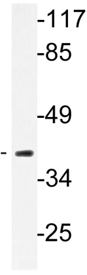 Western blot - Anti-Pepsinogen II/PGC antibody (AB135862)