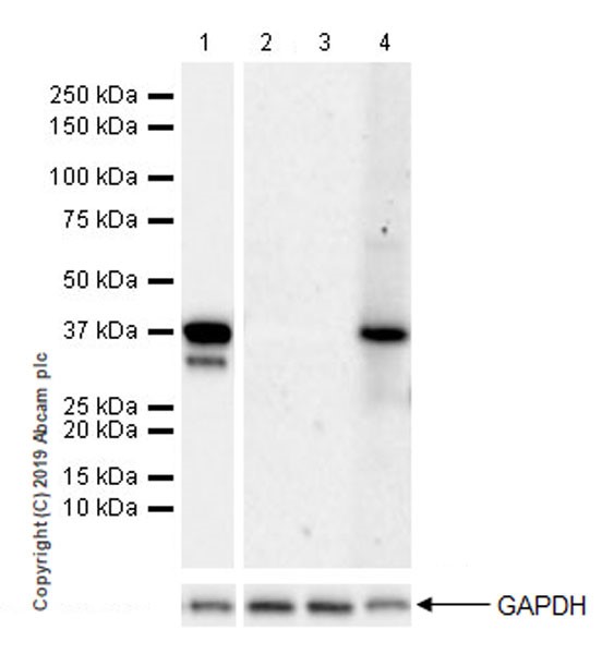 Western blot - Anti-Pepsinogen II/PGC antibody [EPR22843-269] (AB255826), expandable thumbnail