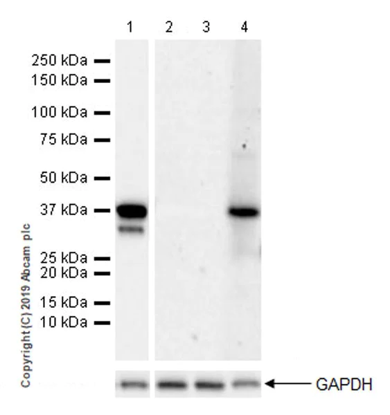 Western blot - Anti-Pepsinogen II/PGC antibody [EPR22843-269] (AB255826)