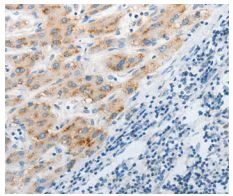 Immunohistochemistry (Formalin/PFA-fixed paraffin-embedded sections) - Anti-PEPT2 antibody - C-terminal (AB198270)