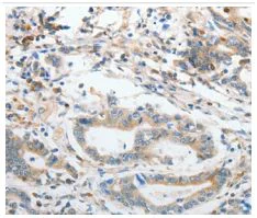Immunohistochemistry (Formalin/PFA-fixed paraffin-embedded sections) - Anti-PEPT2 antibody - C-terminal (AB198270)
