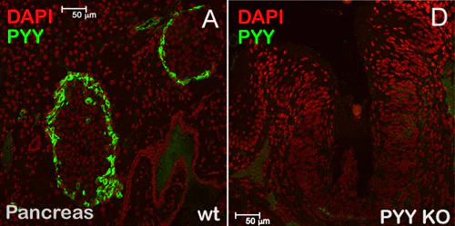 Immunohistochemistry (Formalin/PFA-fixed paraffin-embedded sections) - Anti-Peptide YY/PYY antibody (AB22663)