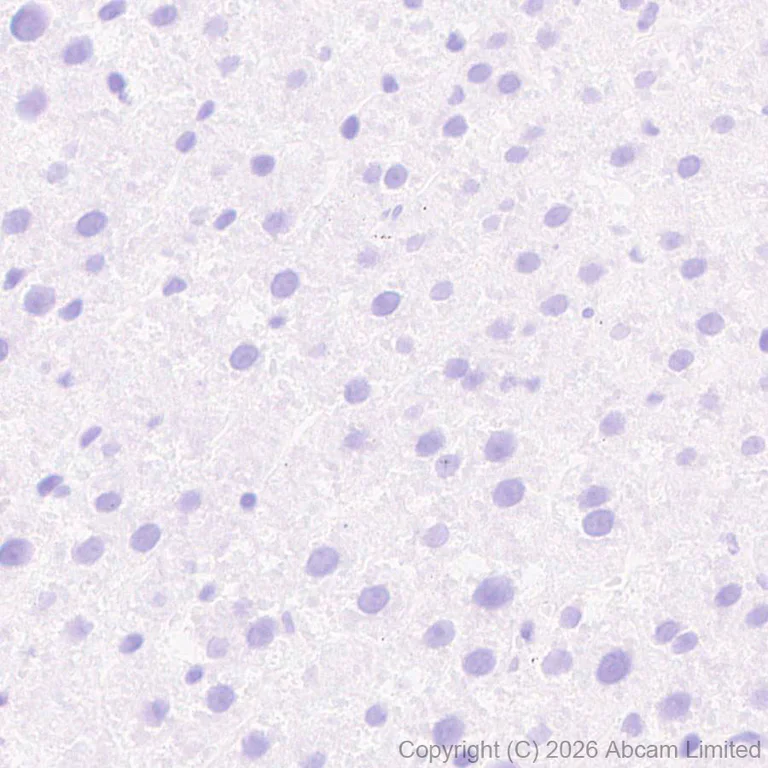 Immunohistochemistry (Formalin/PFA-fixed paraffin-embedded sections) - Anti-Peptide YY/PYY antibody [EPR21011-6R] (AB325645)