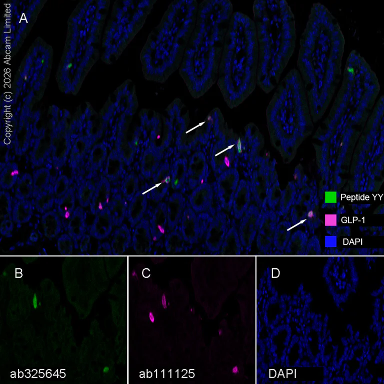 Multiplex immunohistochemistry - Anti-Peptide YY/PYY antibody [EPR21011-6R] (AB325645)