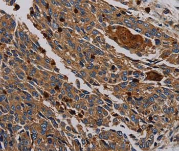 Immunohistochemistry (Formalin/PFA-fixed paraffin-embedded sections) - Anti-PER2 antibody (AB200388), expandable thumbnail