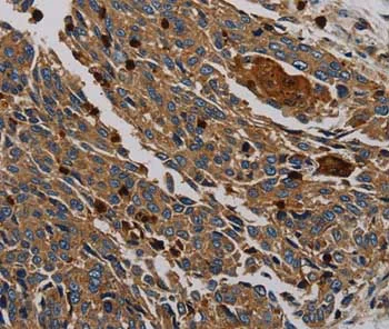 Immunohistochemistry (Formalin/PFA-fixed paraffin-embedded sections) - Anti-PER2 antibody (AB200388)