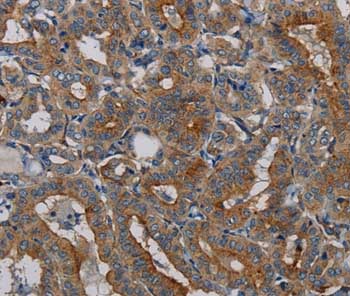 Immunohistochemistry (Formalin/PFA-fixed paraffin-embedded sections) - Anti-PER2 antibody (AB200388), expandable thumbnail