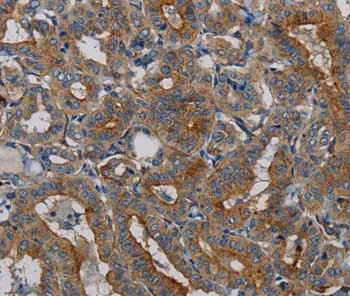 Immunohistochemistry (Formalin/PFA-fixed paraffin-embedded sections) - Anti-PER2 antibody (AB200388)