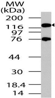 Western blot - Anti-PER2 antibody (AB208163)