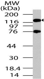 Western blot - Anti-PER2 antibody (AB208163)