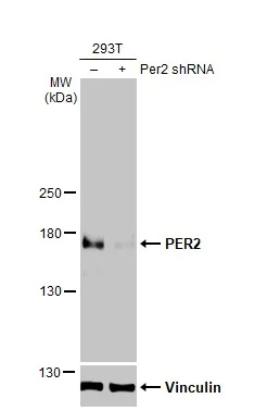 Western blot - Anti-PER2 antibody - N-terminal (AB227727)