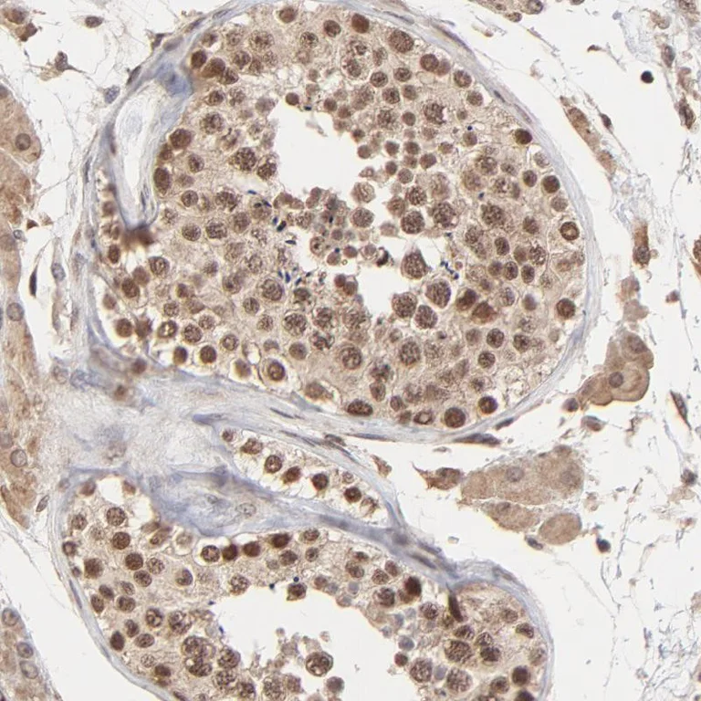 Immunohistochemistry (Formalin/PFA-fixed paraffin-embedded sections) - Anti-Peregrin/BRPF1 antibody (AB251669)