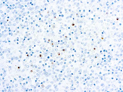 Immunohistochemistry (Formalin/PFA-fixed paraffin-embedded sections) - Anti-Perforin antibody [5B10] (AB89821)