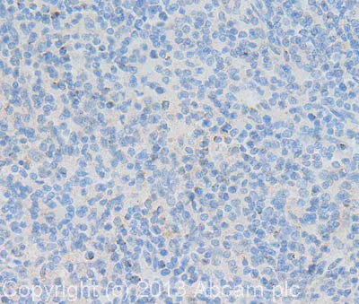Immunohistochemistry (Formalin/PFA-fixed paraffin-embedded sections) - Anti-Perforin antibody [B-D48] - BSA and Azide free (AB47225)