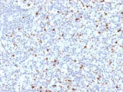Immunohistochemistry (Formalin/PFA-fixed paraffin-embedded sections) - Anti-Perforin antibody [PRF1/2468] (AB238038)
