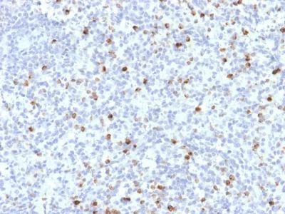 Immunohistochemistry (Formalin/PFA-fixed paraffin-embedded sections) - Anti-Perforin antibody [PRF1/2468] (AB238038)