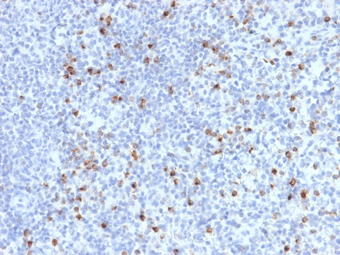 Immunohistochemistry (Formalin/PFA-fixed paraffin-embedded sections) - Anti-Perforin antibody [PRF1/2470] - BSA and Azide free (AB268229), expandable thumbnail