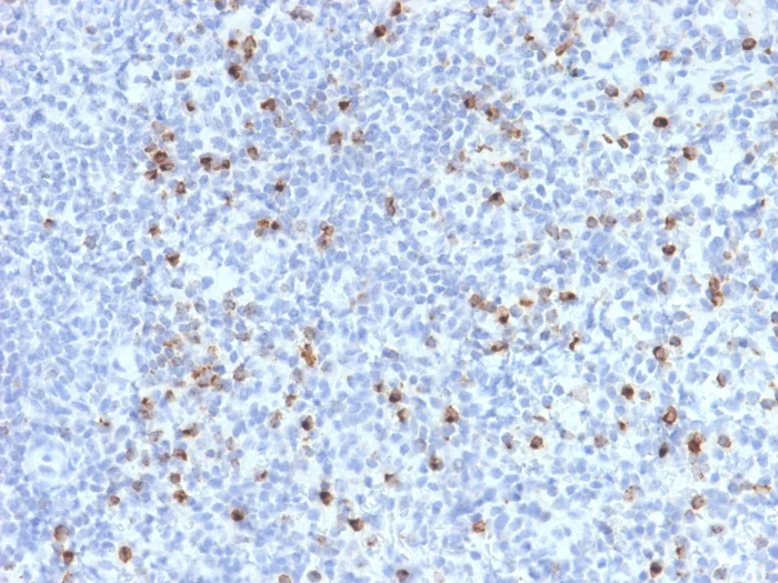 Immunohistochemistry (Formalin/PFA-fixed paraffin-embedded sections) - Anti-Perforin antibody [PRF1/2470] - BSA and Azide free (AB268229)