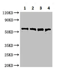 Western blot - Anti-Perfringolysin O antibody (AB225685)