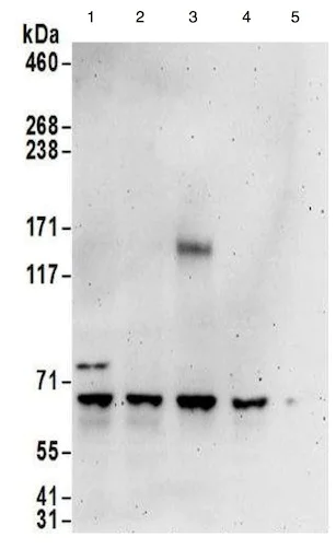 Western blot - Anti-Pericentrin 1/FROUNT antibody (AB176801)