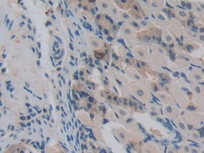 Immunohistochemistry (Formalin/PFA-fixed paraffin-embedded sections) - Anti-Pericentrin 1/FROUNT antibody (AB231958), expandable thumbnail