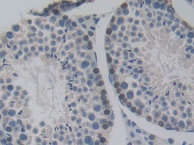 Immunohistochemistry (Formalin/PFA-fixed paraffin-embedded sections) - Anti-Pericentrin 1/FROUNT antibody (AB231958), expandable thumbnail
