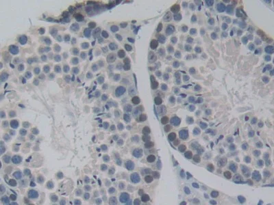 Immunohistochemistry (Formalin/PFA-fixed paraffin-embedded sections) - Anti-Pericentrin 1/FROUNT antibody (AB231958)