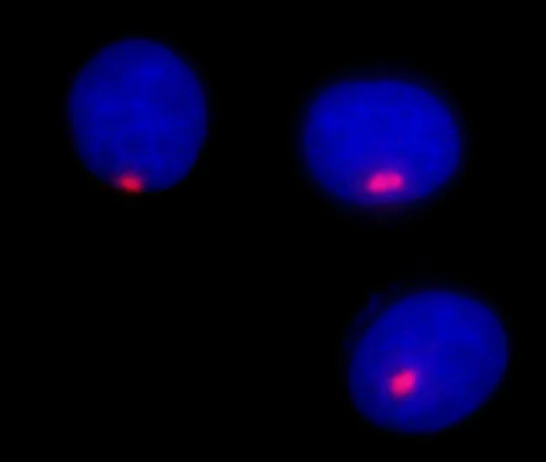 Immunocytochemistry - Anti-Pericentrin antibody (AB99341)