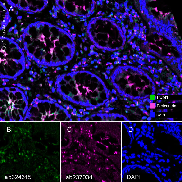 Multiplex immunohistochemistry - Anti-Pericentrin antibody [EPR21987] - BSA and Azide free (AB237034)