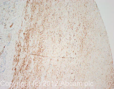 Immunohistochemistry (Formalin/PFA-fixed paraffin-embedded sections) - Pericyte Marker (CD31, NG2, PDGFR beta, CD146, Nestin) Antibody Panel - Human (AB254020)