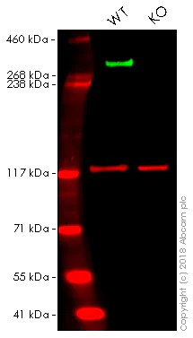 Western blot - Pericyte Marker (CD31, NG2, PDGFR beta, CD146, Nestin) Antibody Panel - Human (AB254020)