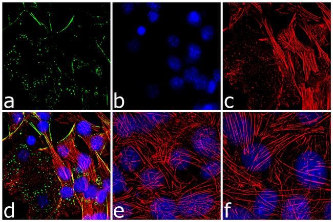 Immunocytochemistry - Anti-Perilipin-1 antibody (AB3526), expandable thumbnail