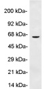 Western blot - Anti-Perilipin-1 antibody (AB3526), expandable thumbnail