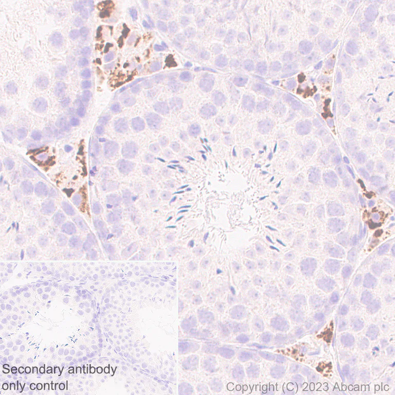 Immunohistochemistry (Formalin/PFA-fixed paraffin-embedded sections) - Anti-Perilipin-1 antibody [EPR28189-12] (AB316115)