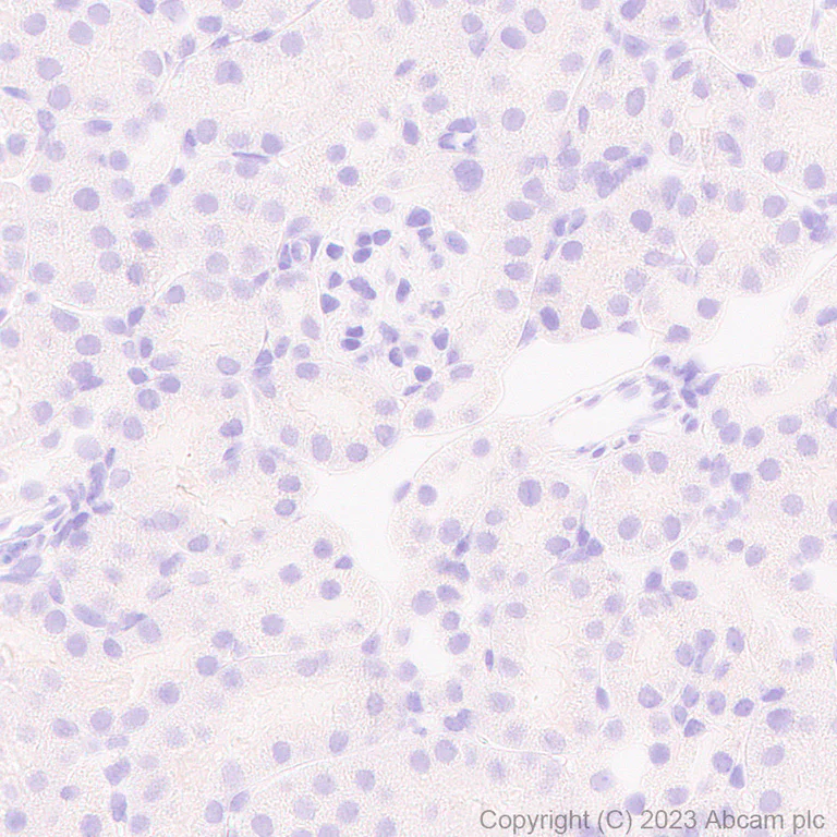 Immunohistochemistry (Formalin/PFA-fixed paraffin-embedded sections) - Anti-Perilipin-1 antibody [EPR28189-12] (AB316115)
