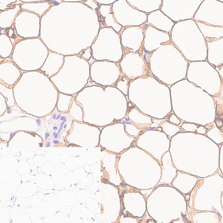 Immunohistochemistry (Formalin/PFA-fixed paraffin-embedded sections) - Anti-Perilipin-1 antibody [EPR28189-12] - BSA and Azide free (AB316116)