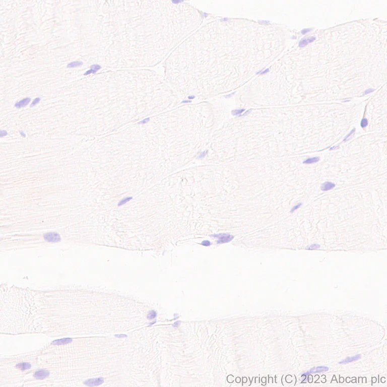 Immunohistochemistry (Formalin/PFA-fixed paraffin-embedded sections) - Anti-Perilipin-1 antibody [EPR28189-12] - BSA and Azide free (AB316116)