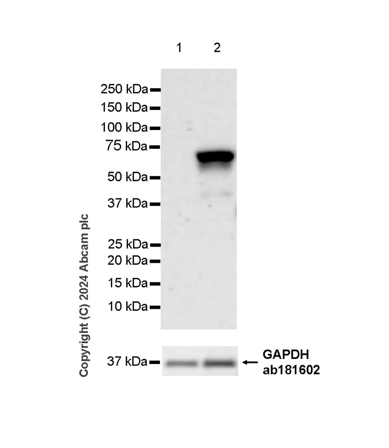Western blot - Anti-Perilipin-1 antibody [EPR28189-66] - BSA and Azide free (AB317261)
