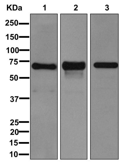 Western blot - Anti-Perilipin-1 antibody [EPR3753(2)] (AB172907), expandable thumbnail