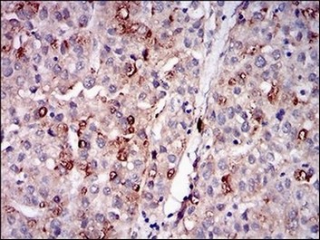 Immunohistochemistry (Formalin/PFA-fixed paraffin-embedded sections) - Anti Perilipin-2 antibody [2C5A3] (AB181463), expandable thumbnail