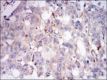 Immunohistochemistry (Formalin/PFA-fixed paraffin-embedded sections) - Anti Perilipin-2 antibody [2C5A3] (AB181463), expandable thumbnail