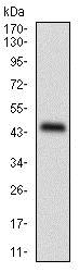 Western blot - Anti Perilipin-2 antibody [2C5A3] (AB181463), expandable thumbnail