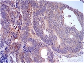 Immunohistochemistry (Formalin/PFA-fixed paraffin-embedded sections) - Anti Perilipin-2 antibody [2C5H8] (ab181452), expandable thumbnail