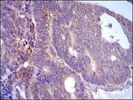 Immunohistochemistry (Formalin/PFA-fixed paraffin-embedded sections) - Anti-Perilipin-2 antibody [2C5H8] (AB181452)