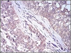 Immunohistochemistry (Formalin/PFA-fixed paraffin-embedded sections) - Anti-Perilipin-2 antibody [2C5H8] (AB181452)